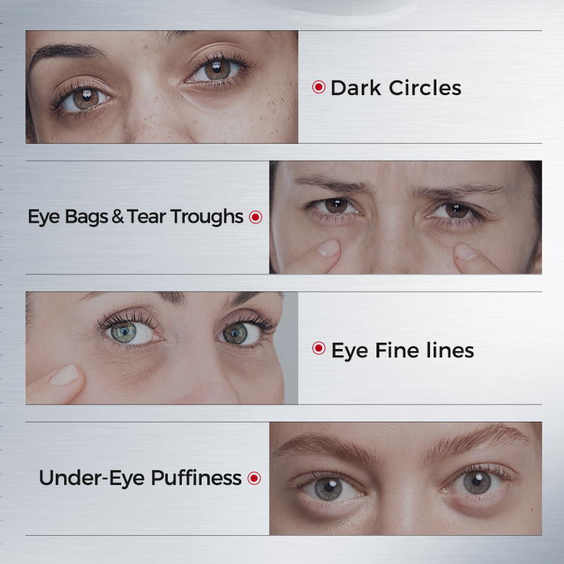 Eye Patches for Dark Circles – - Sheet Mask Collagen recension och pris