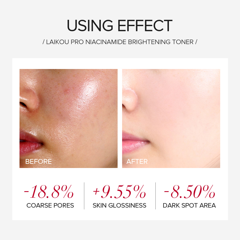 LAIKOU PRO Niacinamide 4Pcs Br - Korean Skincare Routine recension och pris