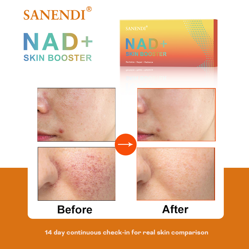 Sanendi NAD+ Korea Skincare Pr - Korean Skincare Routine recension och pris