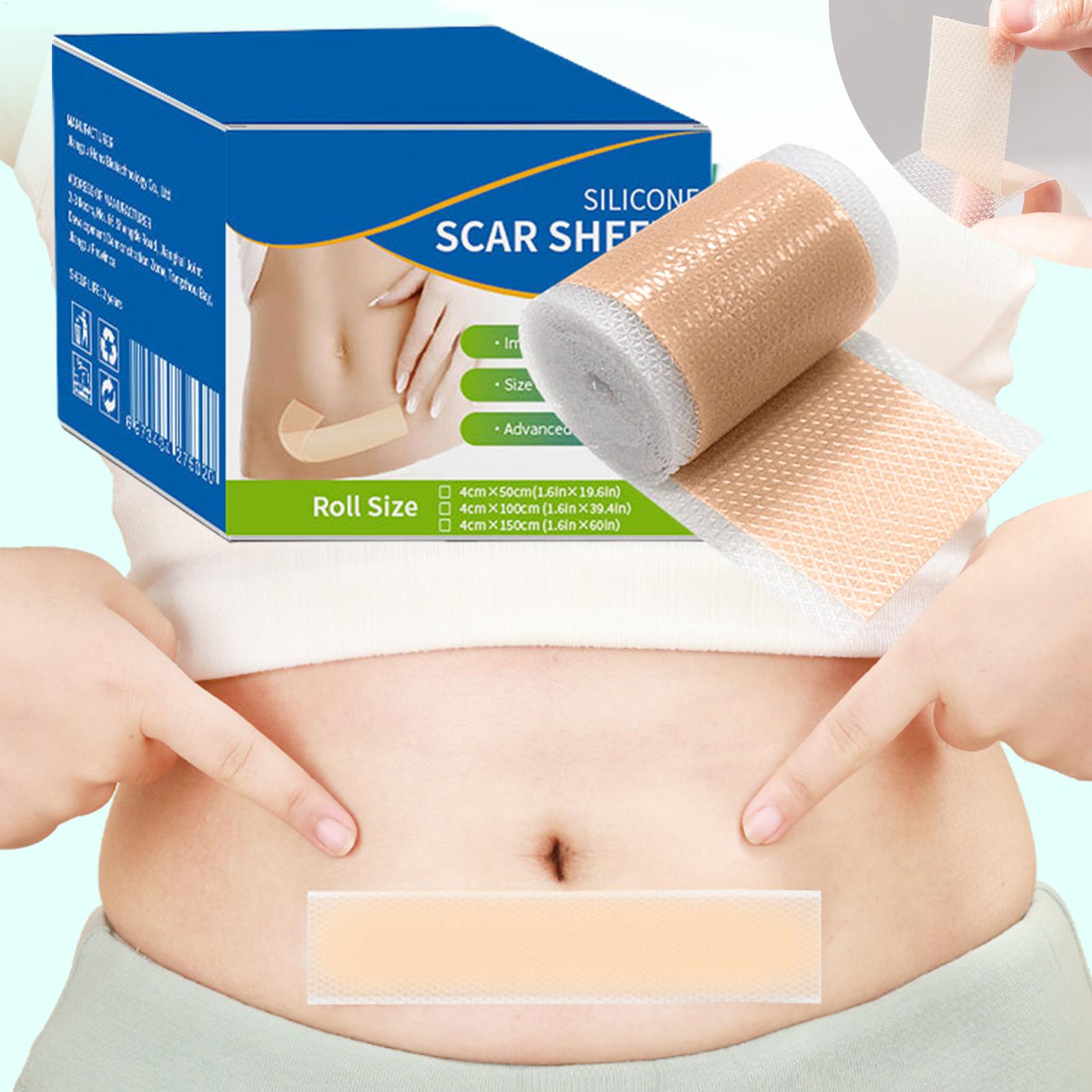 1 Roll Silicone Scar Sheets 4c - Sheet Mask Collagen recension och pris